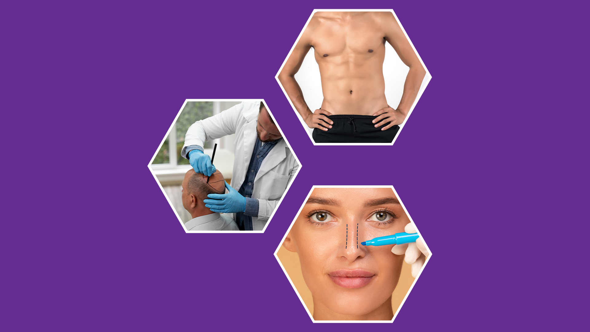 A Purple Background Showcasing The Pictures Of A Man And A Woman Undergoing Haitransplant Surgery, Rhinoplasty Surgery,Gynecomastia Surgery